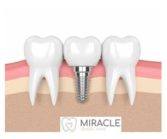 Miracle Dental Care - Dentist Croydon Park