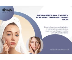 How Microneedling Sydney Helps Achieve Healthier Skin