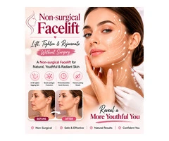Non-Surgical Facelift: Advanced Skin Rejuvenation Solutions