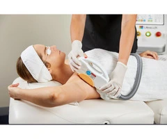 IPL Hair Removal – Smooth Skin in Chapel Street, Prahran