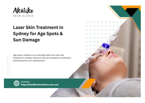 Laser Solutions for Sydney’s Sun-Exposed Skin