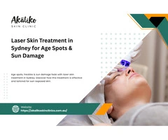 Laser Solutions for Sydney’s Sun-Exposed Skin