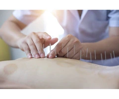 Acupuncturist in Adelaide | Natural Pain Relief & Wellness Care