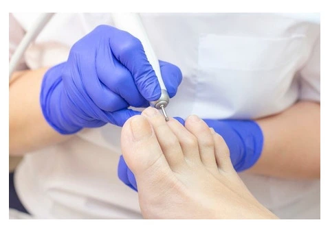 Affordable Podiatrist in Cheltenham for Foot Care Solutions