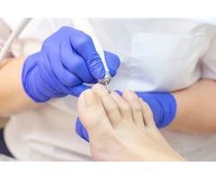 Affordable Podiatrist in Cheltenham for Foot Care Solutions