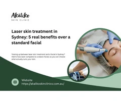 5 benefits of laser skin treatment vs standard facial treatment in Sydney