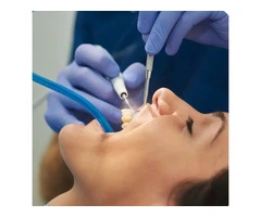 Teeth Cleaning Penrith