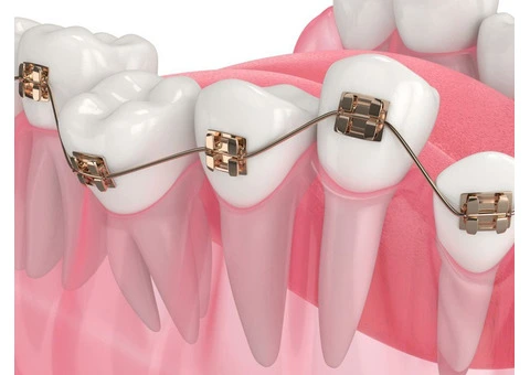 Dentist Hills Area – Professional Dental Care You Can Trust - 5/6