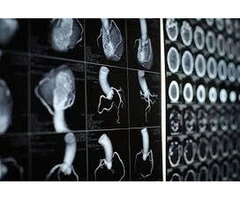 Cardiologist Craigieburn
