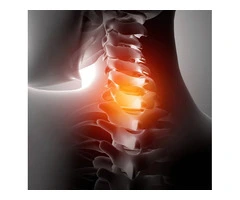 Spinal Fusions in Melbourne for Back Pain & Spine Problems