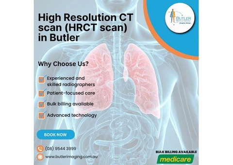 High Resolution CT Scan (HRCT) at Butler Medical Imaging. (08) 9544 3999