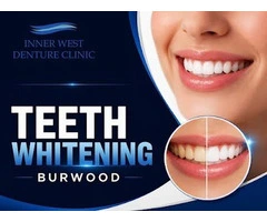 Achieve a Brighter Smile with Professional Teeth Whitening in Burwood - Inner West Denture Clinic