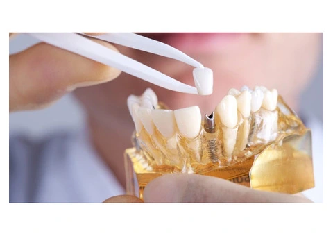 Need a Convenient Dentist East Melbourne for Checkups?