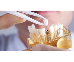 Need a Convenient Dentist East Melbourne for Checkups?