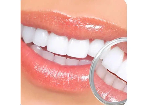 Teeth Whitening Penrith