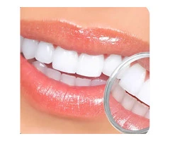 Teeth Whitening Penrith