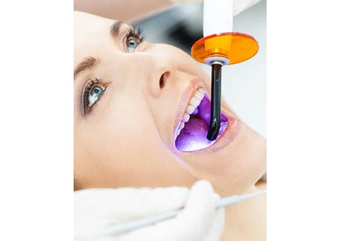 Teeth Whitening Strathpine