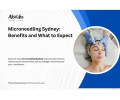 Microneedling Sydney: Benefits, Process, and Results