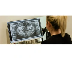 Learn About the Wisdom Teeth Removals of the Nearby Dental Clinic in Ormeau City