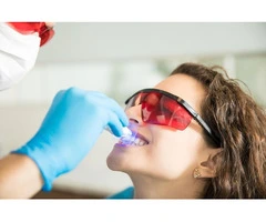 Access to Professional Teeth Whitening Services in Caulfield