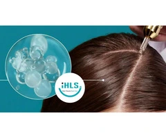 Discover the Benefits of Peptides for Hair Restoration in Perth
