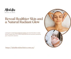 Reveal Healthier, More Radiant Skin with Akaliko Skin Clinic