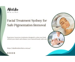 Facial Treatment Sydney for Safe Pigmentation Removal