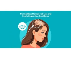 Discover Effective Female Hair Loss Treatments in Perth