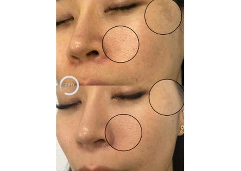 Restore Skin Confidence with Advanced Skin Tightening