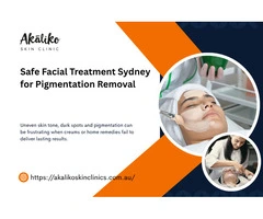 Safe Facial Treatment Sydney for Pigmentation Removal