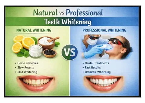 Professional Teeth Whitening in Baulkham Hills for a Brighter Smile