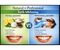 Professional Teeth Whitening in Baulkham Hills for a Brighter Smile