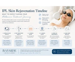 Your IPL Skin Rejuvenation Journey in Melbourne Starts Here