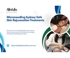 Microneedling Sydney for Healthier, Radiant Skin Results
