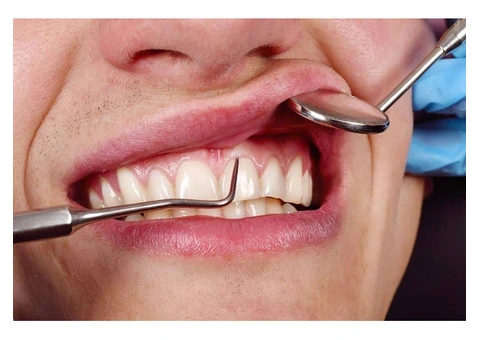 Gum Infection Treatment to Protect Your Smile