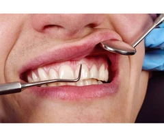 Gum Infection Treatment to Protect Your Smile