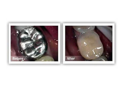 Best Cosmetic Dentist in Melbourne | Cosmetic & Laser Dentistry at CLDC - 2/5