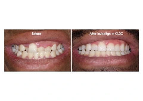 Best Cosmetic Dentist in Melbourne | Cosmetic & Laser Dentistry at CLDC - 4/5