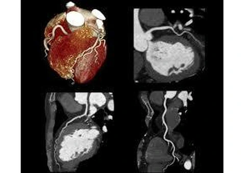 Cardiac CT Donnybrook