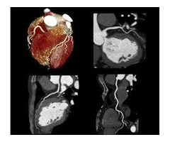 Cardiac CT Donnybrook