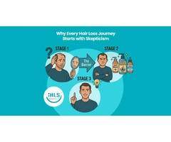 Turn Hair Loss Skepticism into Confidence with IHLS Australia