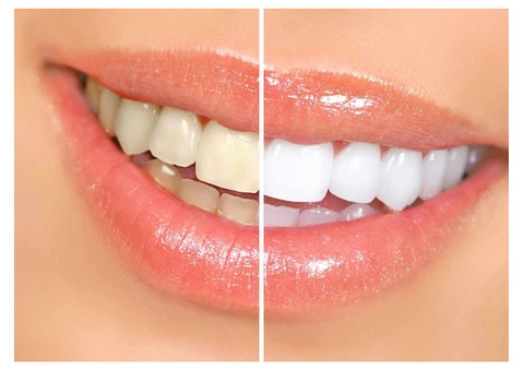 Trusted Dentist Noranda – Quality Dental Care at Malaga Dental Clinic - 5/5