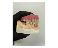 Same Day Denture Repair Blue Mountains | Emergency Denture Fix