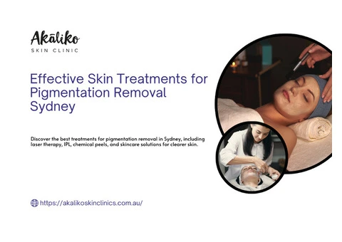 Pigmentation Removal Sydney: Best Treatments for Clear Skin