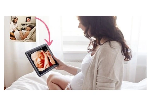 See Your Baby Smile with a Live 4D/5D Realistic Vue Scan