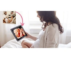 See Your Baby Smile with a Live 4D/5D Realistic Vue Scan