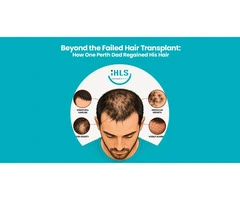 Regain Confidence with Expert Hair Restoration in Perth