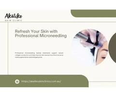Refresh Your Skin with Professional Microneedling in Sydney