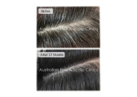 Hair Shaft Repair Treatment for Healthier Hair