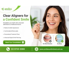 Clear Aligners for a Confident Smile Without Traditional Braces